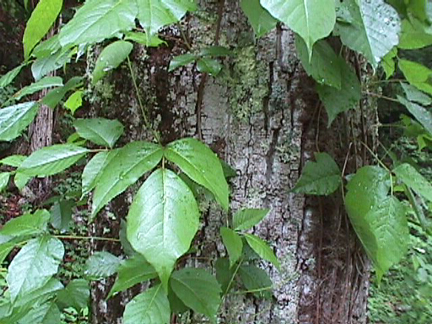poison ivy rash. serious rash of poison ivy